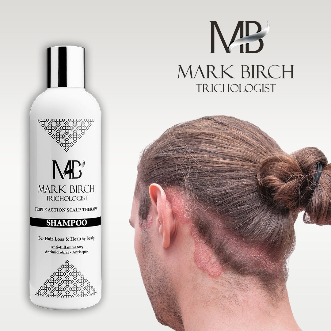 Scalp problem products