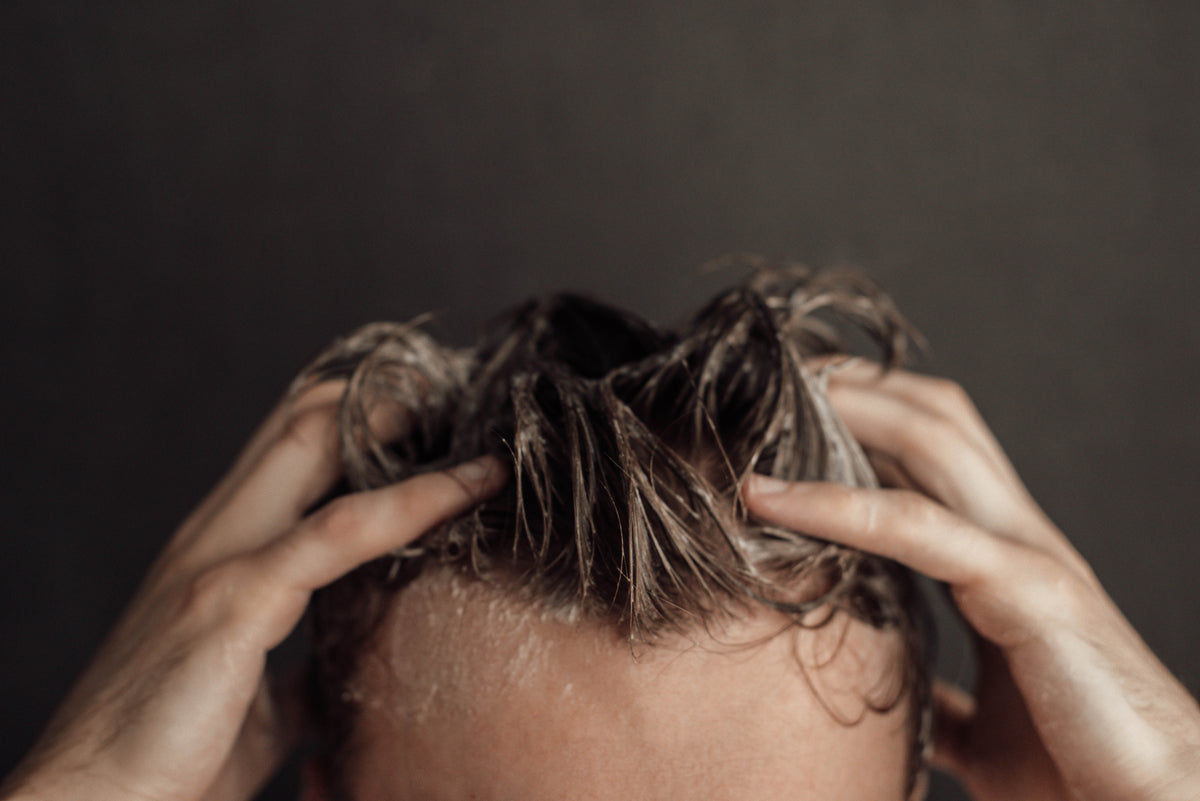 Scalp Problems – MARK BIRCH HAIR